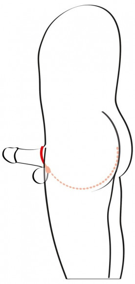 Эрекционное кольцо с цепочкой для стимуляции ягодиц Эрекционное кольцо с цепочкой для стимуляции ягодиц