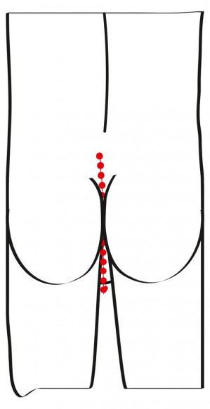 Эрекционное кольцо с цепочкой для стимуляции ягодиц Эрекционное кольцо с цепочкой для стимуляции ягодиц